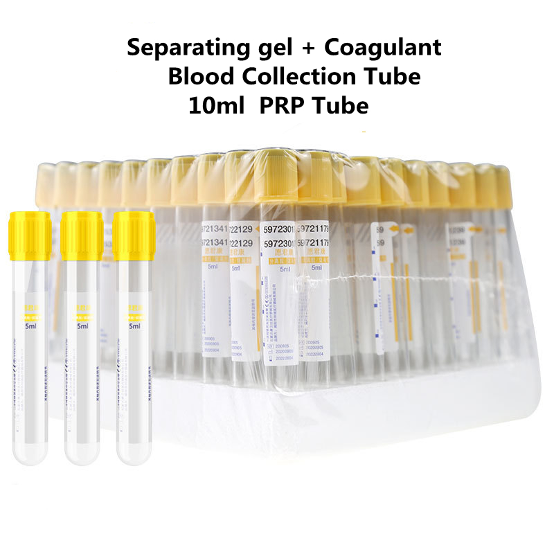 Medical Lab Blood Test - Wegwerp vacuüm bloedafnamebuis Scheidingsgel en stolselactivator