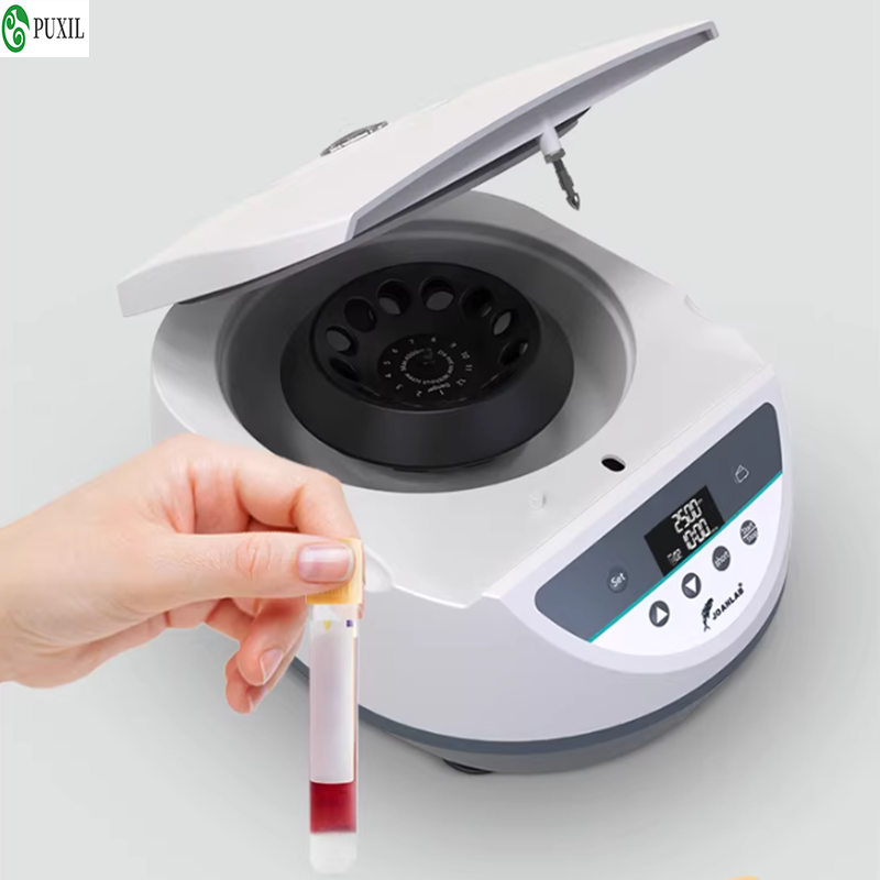 AB plasma centrifuge laborator - Blood Collection Tube recensie en prijs