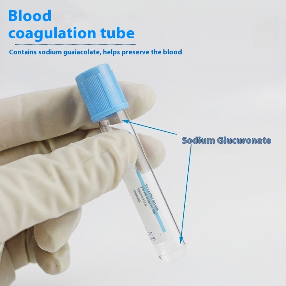 Wegwerp Natriumcitraat 1:9 Ste - Blood Collection Tube recensie en prijs