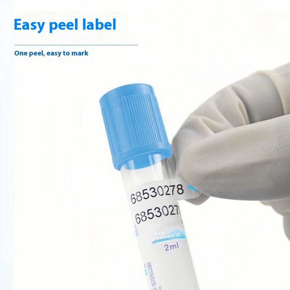 Wegwerp Natriumcitraat 1:9 Ste - Blood Collection Tube recensie en prijs