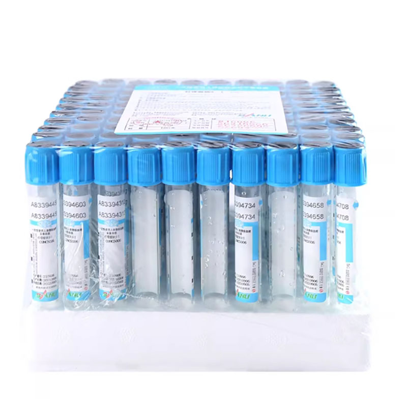100 stuks Lab Wegwerp Natriumc - Blood Collection Tube recensie en prijs