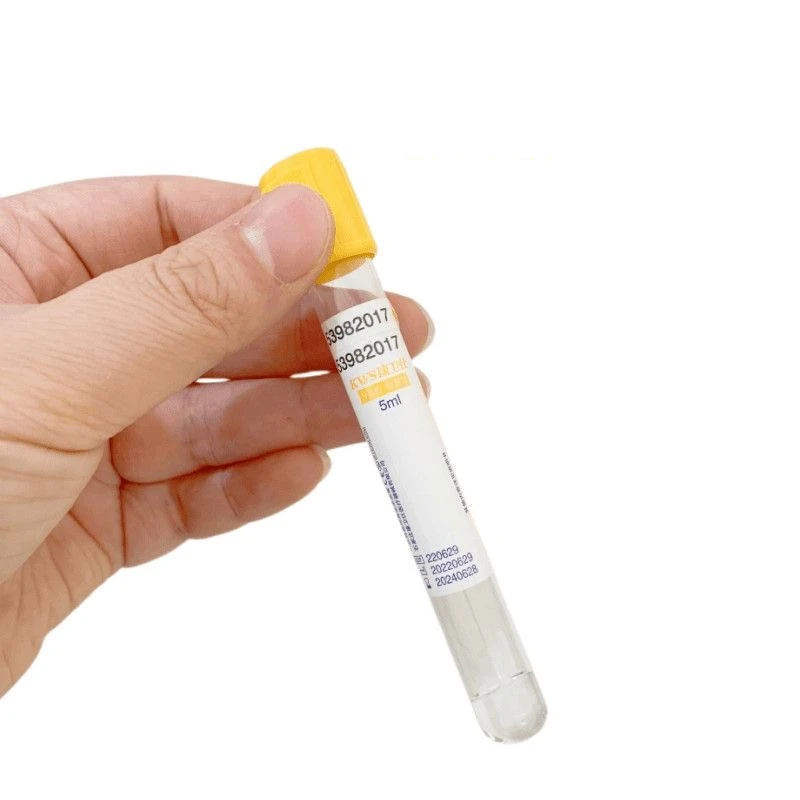 Wegwerp vacuüm bloedafnamebuis - Medical Lab Blood Test recensie en prijs