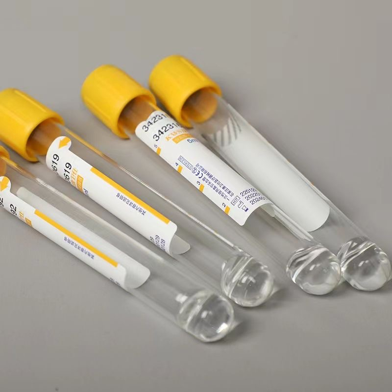 Wegwerp vacuüm bloedafnamebuis - Medical Lab Blood Test recensie en prijs